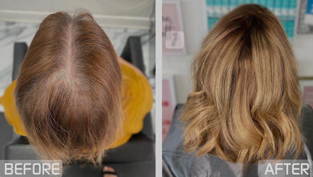 Hair Wear Before & After